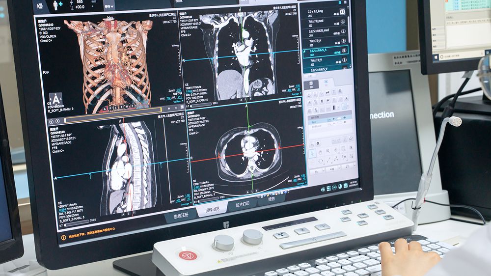 Medical Imaging Diagnosis